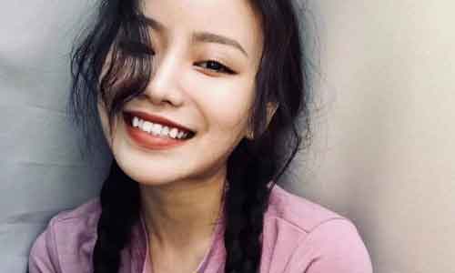 戴美容冠注意事项有哪些?河源科普!